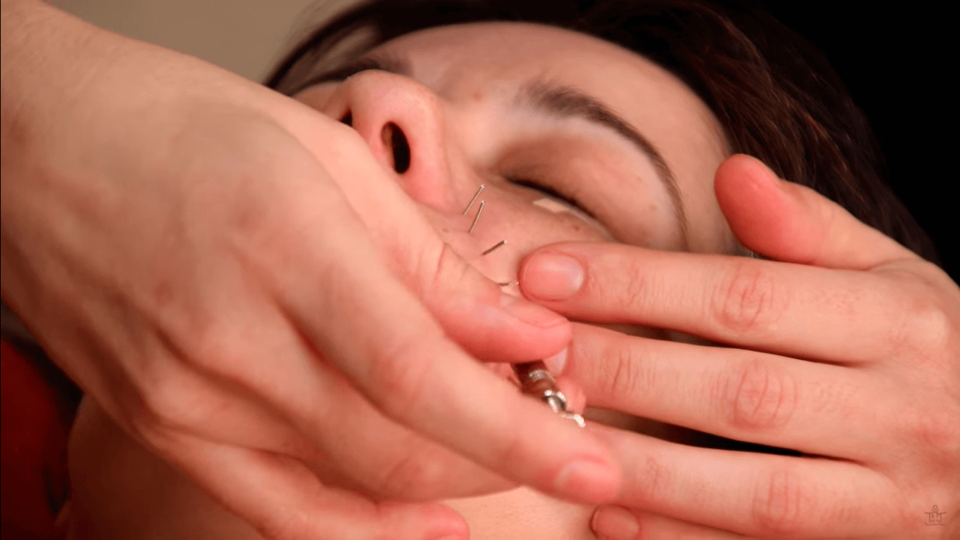 Cómo hacer acupuntura facial y kobido