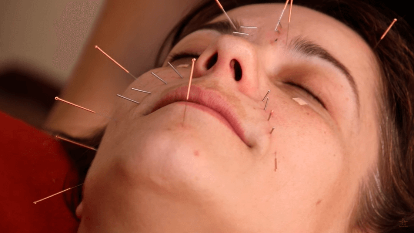 Cómo hacer un masaje kobido y acupuntura facial